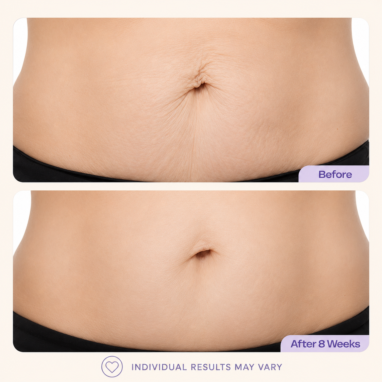Belly Cream